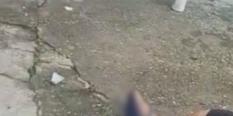 Vídeo mostra homem que ficou com o pé dil4cerad0 após pisar em catolé em Manaus