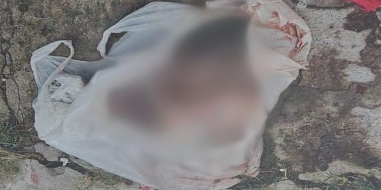 Feto já estava todo perfeitinho e com aproximadamente 40 semanas. Foto: Divulgação