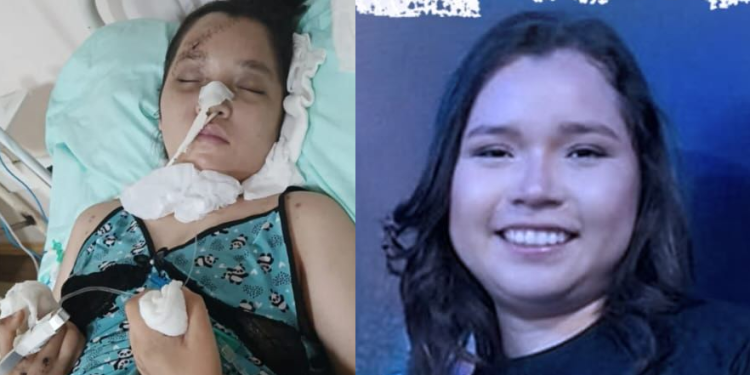 A situação ainda é delicada e ela continua internada em hospital em Manaus. Foto: Reprodução