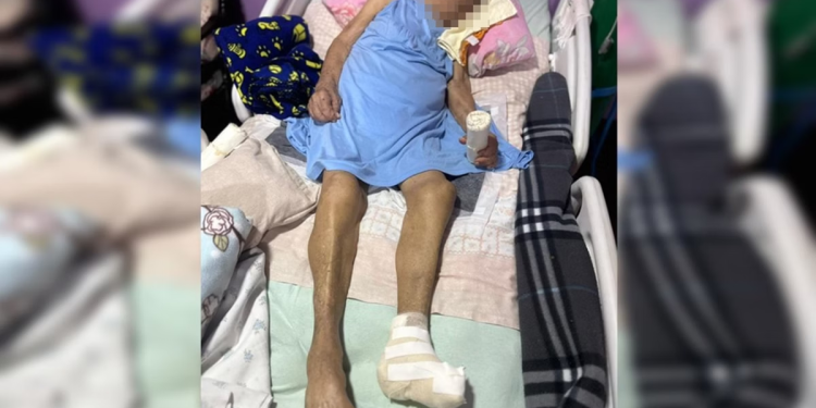 A idosa está internada e agora precisa amputar parte da perna. Foto: Reprodução