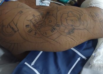 O homem foi conduzido a unidade pelo Serviço de Atendimento Móvel de Urgência (Samu), vítima de agressão física. Foto: Divulgação/SES-AM