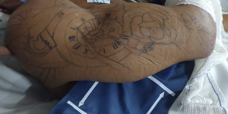 O homem foi conduzido a unidade pelo Serviço de Atendimento Móvel de Urgência (Samu), vítima de agressão física. Foto: Divulgação/SES-AM