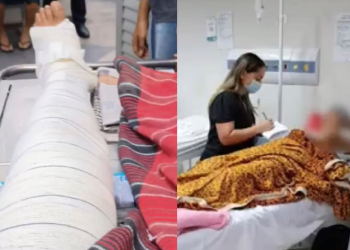 A vítima está internada e vai precisar passar por cirurgia. Foto: Reprodução