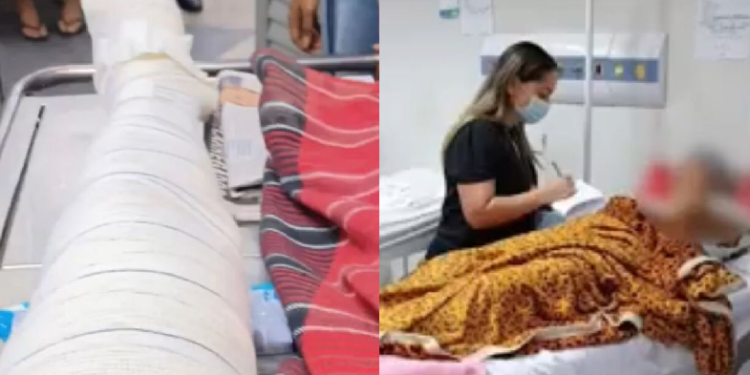 A vítima está internada e vai precisar passar por cirurgia. Foto: Reprodução