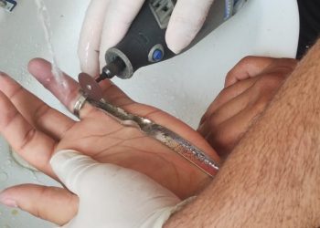 O CBMAM utiliza ferramentas de corte específicas para retirar o material em segurança. Foto: Arquivo/CBMAM