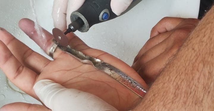 O CBMAM utiliza ferramentas de corte específicas para retirar o material em segurança. Foto: Arquivo/CBMAM