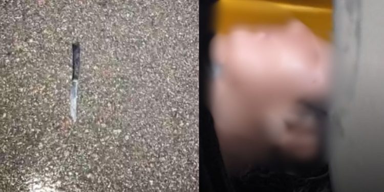 Na Praça da Matriz, mulher é esfaque4da e se nega a dizer quem a fer1u