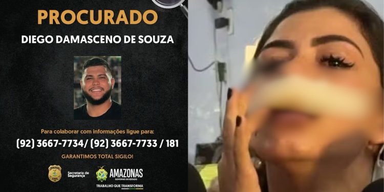 Justiça determina prisão de cantor de Manacapuru por agred1r a namorada com socos