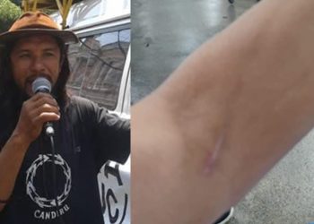 Professor de filosofia é atacado por aluno dentro da escola em Manaus: 'ele me f3riu com a caneta'