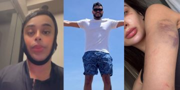 “Apanhou porque quis”: Blogueiro tenta jogar a culpa para Miss Manaus que foi esp4ncad4 pelo ex