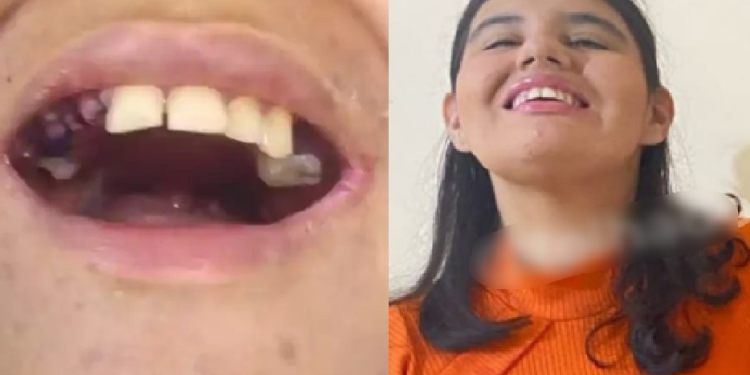 A jovem sempre é sedada para os procedimentos e ia regularmente ao dentista. Foto: Reprodução