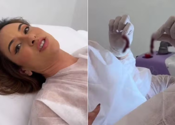 A postagem incluía uma foto da pele que foi retirada. Foto: Reprodução