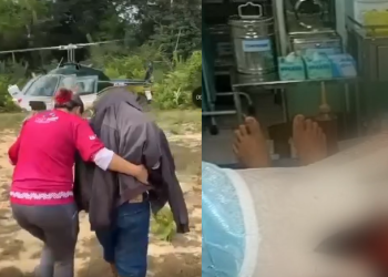 O indígena precisou de mais cuidados médicos devido gravidade do ferimento. Foto: Reprodução