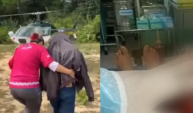 O indígena precisou de mais cuidados médicos devido gravidade do ferimento. Foto: Reprodução