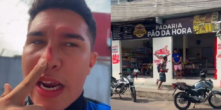 O trabalhador fez um vídeo e mostrou o nariz sangrando após o corte. Foto: Reprodução