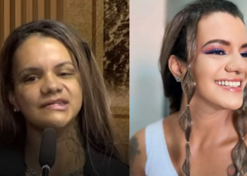 Juliana Garcia dos Santos Soares passou por inúmeras cirurgias. Foto: Reprodução