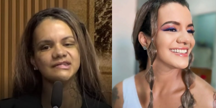 Juliana Garcia dos Santos Soares passou por inúmeras cirurgias. Foto: Reprodução