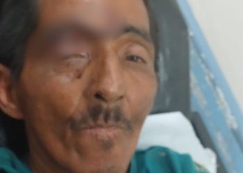 Homem ferid0 que não consegue falar recebe alta e aguarda contato da família em hospital