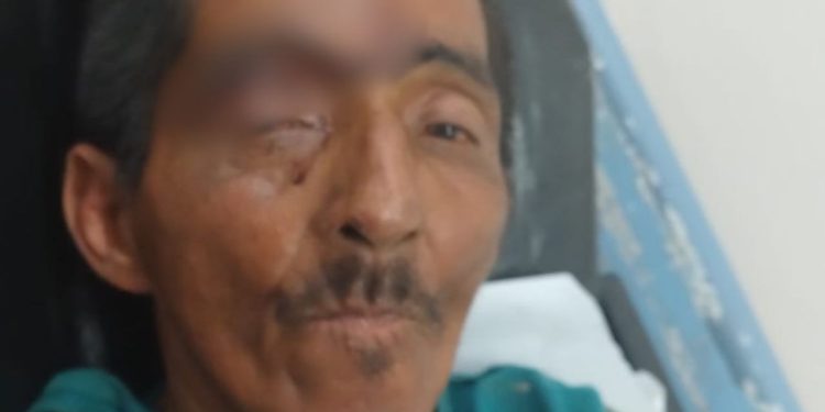 Homem ferid0 que não consegue falar recebe alta e aguarda contato da família em hospital