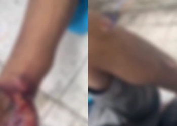 A vítima foi resgatada ainda com vida e encaminhada às pressas para um hospital da rede pública. Foto: Reprodução