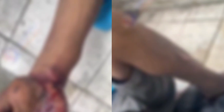 A vítima foi resgatada ainda com vida e encaminhada às pressas para um hospital da rede pública. Foto: Reprodução