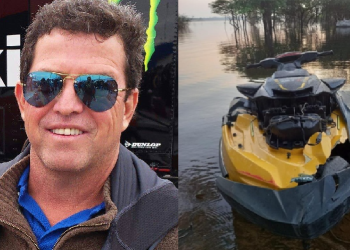 Robson sofreu fraturas faciais e na bacia. Foto: Reprodução