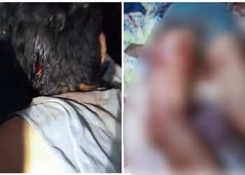 Mesmo ferido, o homem conseguiu pedir socorro. Foto: Reprodução