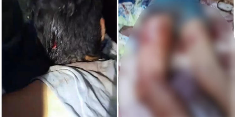 Mesmo ferido, o homem conseguiu pedir socorro. Foto: Reprodução