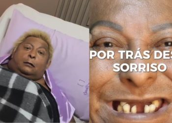 Patixa Teló passa por cirurgia odontológica delicada e descobre bactéria que ameaçava o coração