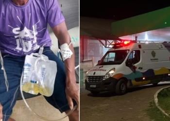 Eliomar repousava após o almoço quando o raio atingiu a residência. Foto: Reprodução