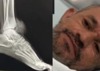 Vídeo: Homem denuncia ter sido b4lead0 no pé por policiais durante operação em Presidente Figueiredo