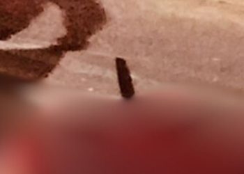 Veja: Homem fica com fac4 cravada nas costas após ser m0rt0 pelo próprio irmão em Itacoatiara