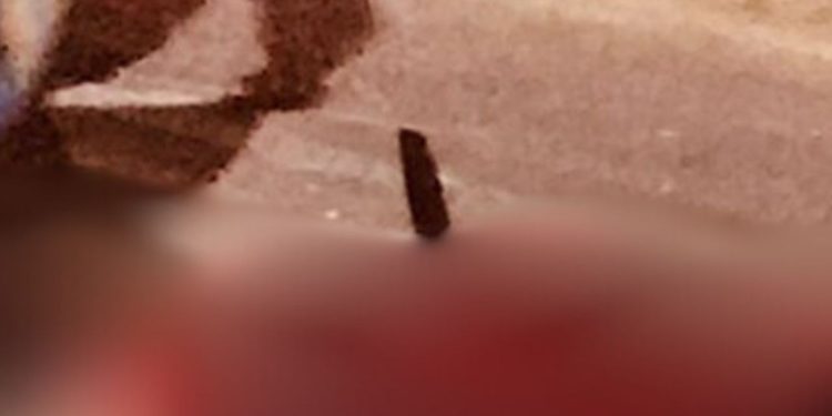 Veja: Homem fica com fac4 cravada nas costas após ser m0rt0 pelo próprio irmão em Itacoatiara