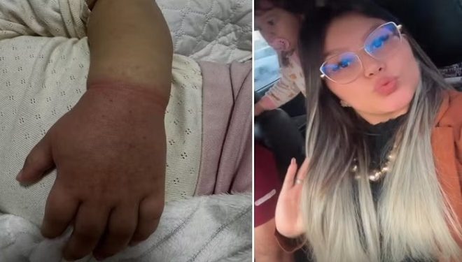 Carolina Silva, a mãe da criança, disse que não percebeu que a filha havia colocado o acessório de volta no braço. Foto: Reprodução