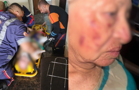 Os idosos precisaram ser hospitalizados. Foto: Reprodução