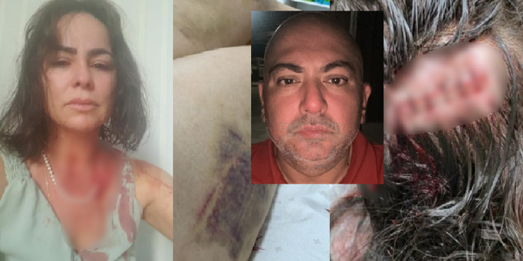 Rafaela Gorayeb já registrou o caso na polícia. Foto: Reprodução