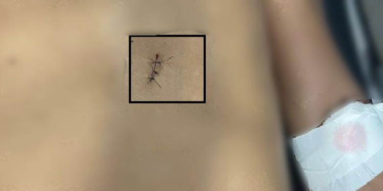 O jovem foi encaminhado para o hospital, mas não resistiu. Foto: Reprodução