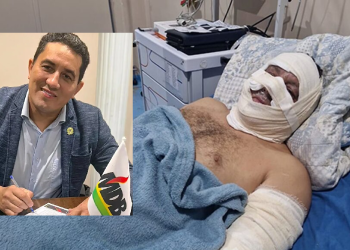 O ex-prefeito está internado em hospital em Manaus. Foto: Reprodução