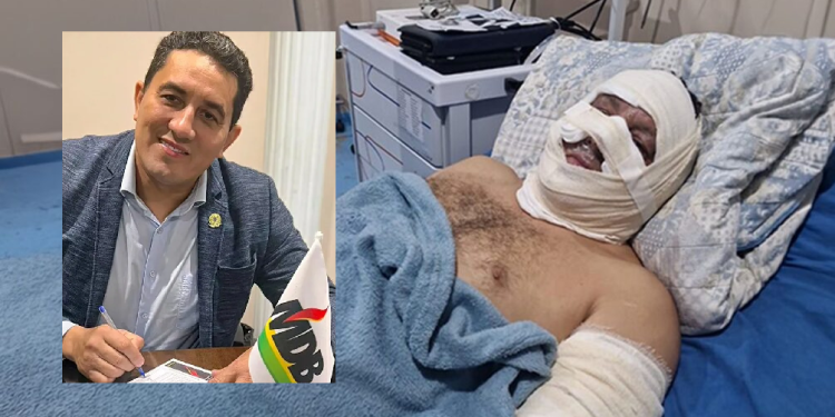 O ex-prefeito está internado em hospital em Manaus. Foto: Reprodução