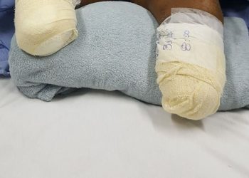 Hospital Santa Júlia é processado após paciente m0rr3r depois de amputações