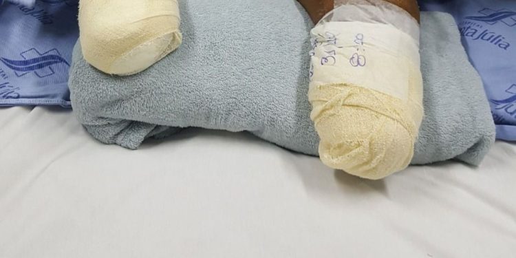 Hospital Santa Júlia é processado após paciente m0rr3r depois de amputações