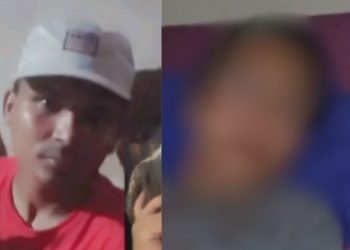 Mulher é internada após ser brut4lmente agr3dida pelo marido em Coari; veja