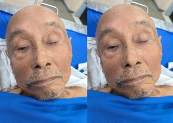 Idoso deu entrada na unidade pelo SAMU após ter sofrido queda em casa. Foto: Divulgação SES