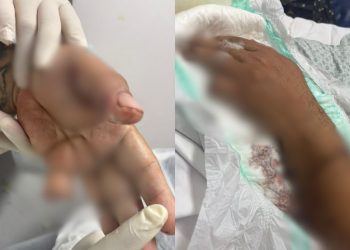 Motorista de aplicativo é at4cado com terçad0 e pit bull de passageiro em Manaus e tem dedo amput4d0