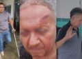 Idoso de 73 anos é agr3d1do com muleta na cabeça por policial após discussão por Pix em Itacoatiara