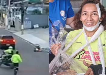 Marleide Sales da Silva, de 52 anos, sofreu fraturas nas clavículas. Foto: Reprodução