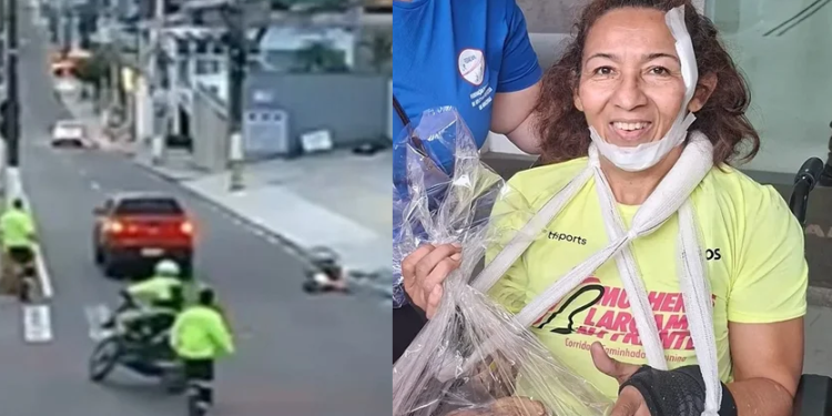 Marleide Sales da Silva, de 52 anos, sofreu fraturas nas clavículas. Foto: Reprodução