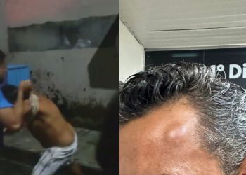 Vídeo: Músico é agredido por dois irmãos após discussão por lixo em rua de Manaus