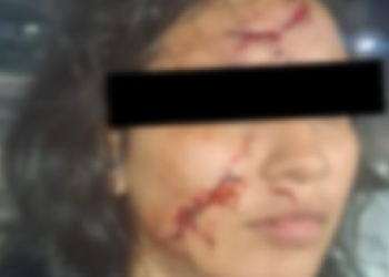 O caso expôs, mais uma vez, as falhas no acolhimento a vítimas fora dos dias úteis. Foto: Reprodução