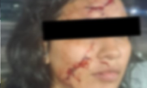 O caso expôs, mais uma vez, as falhas no acolhimento a vítimas fora dos dias úteis. Foto: Reprodução